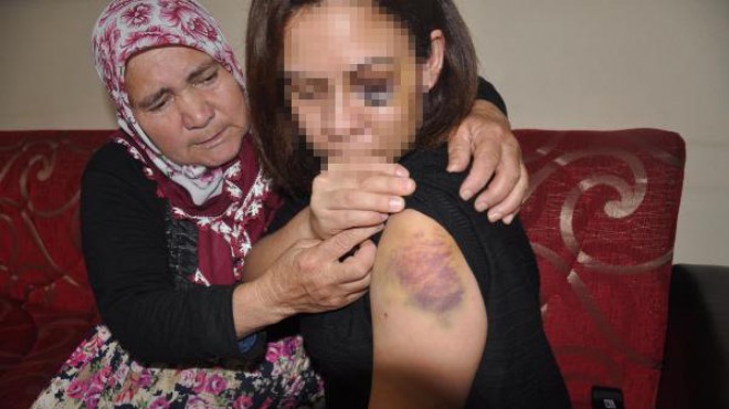 Aydın'da genç kadının çığlığı: Öldürülmek istemiyorum!