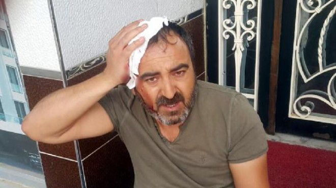 Aydın'da yerel gazete sahibine sopalı saldırı